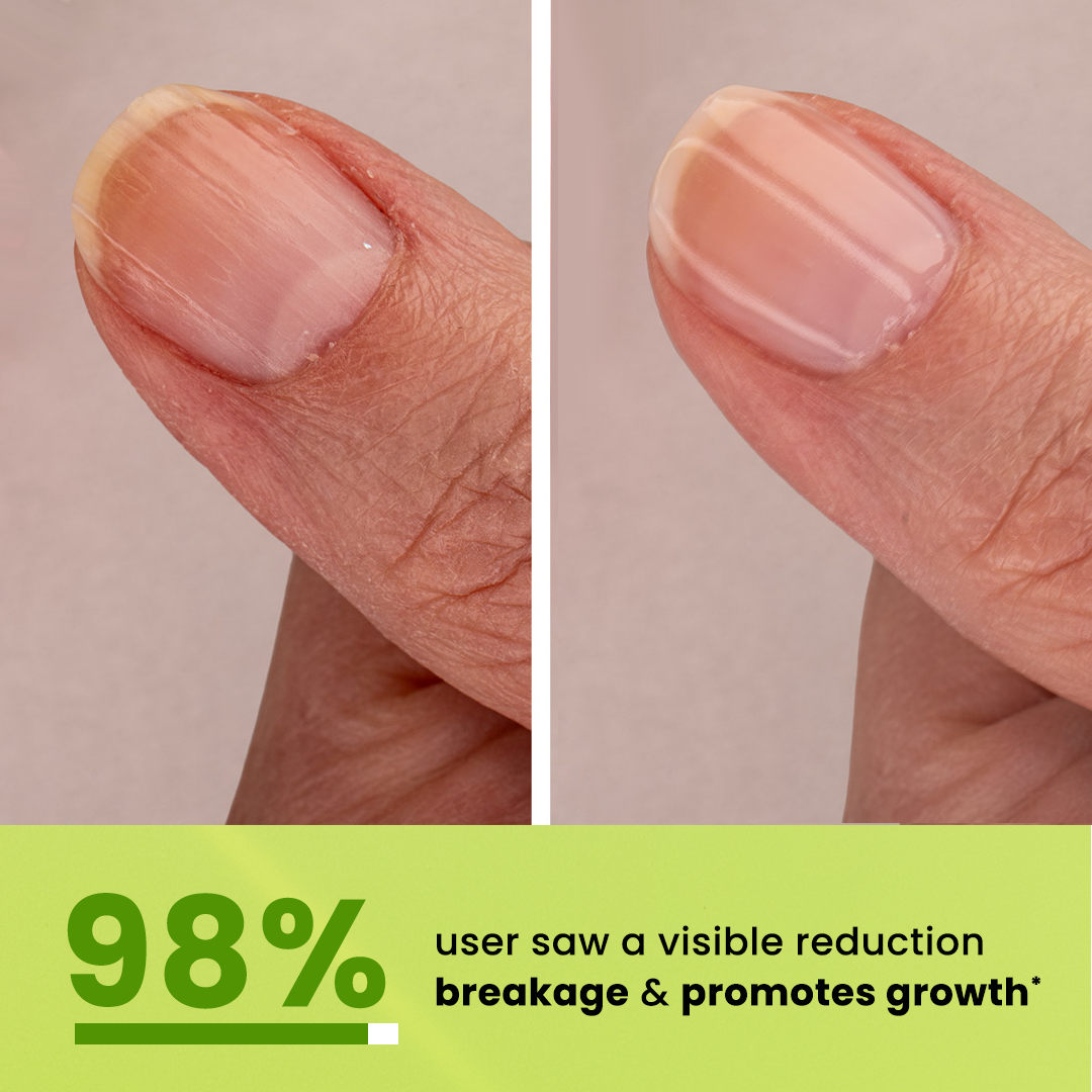 Advanced Nail Repair Serum Nail Repair & Growth Serum - 15 ml